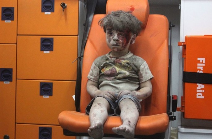 Hình ảnh Omran sau vụ tấn công trên không của chính phủ Syria